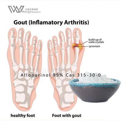 Antigout API Zyloprim Allopurinol Powder 99% for treat kidney stones
