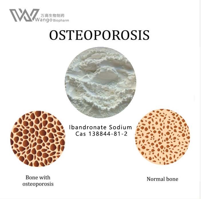 Hypercalcemia API Active Pharmaceutical Ingredient Ibandronate Sodium